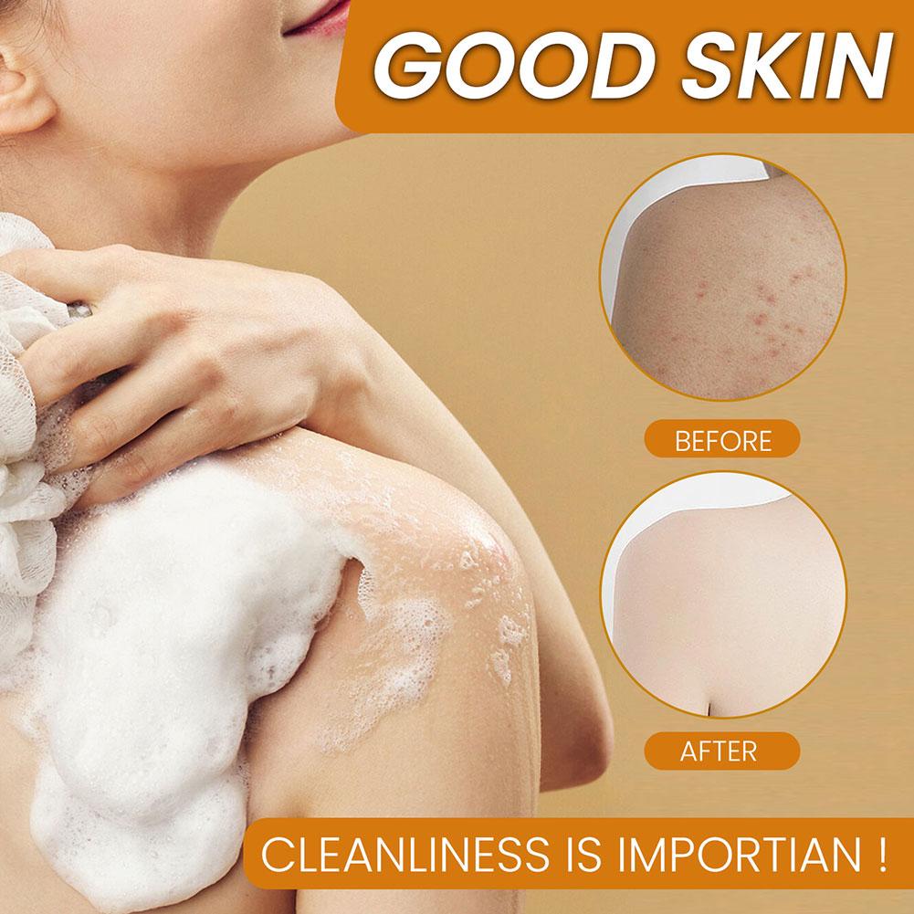 صابون الكركم المصنوع يدويًا 100 جرام، صابون حمض الكوجيك بالليمون، صابون الاستحمام والوجه، التنظيف العميق للعناية ببشرة الوجه والجسم