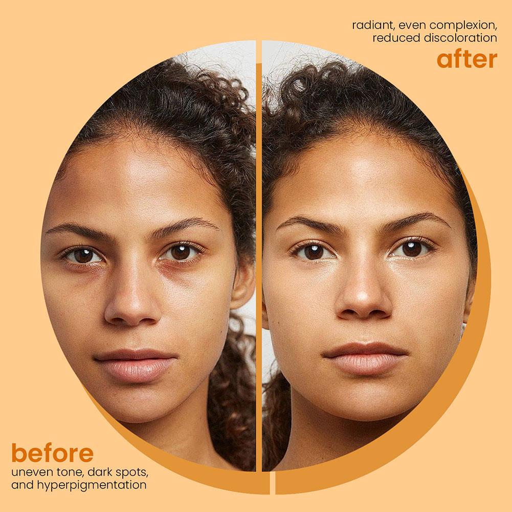 صابون الكركم المصنوع يدويًا 100 جرام، صابون حمض الكوجيك بالليمون، صابون الاستحمام والوجه، التنظيف العميق للعناية ببشرة الوجه والجسم