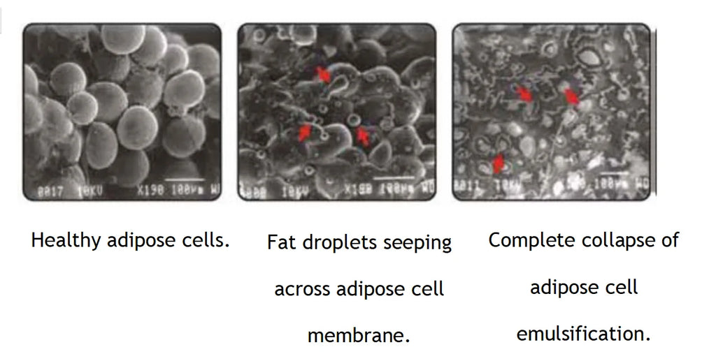 جهاز LuxMaster Emerald Laser Slim 2025 لعلاج فقدان الدهون في الجسم باستخدام ليزر 10D للصحة والعافية
