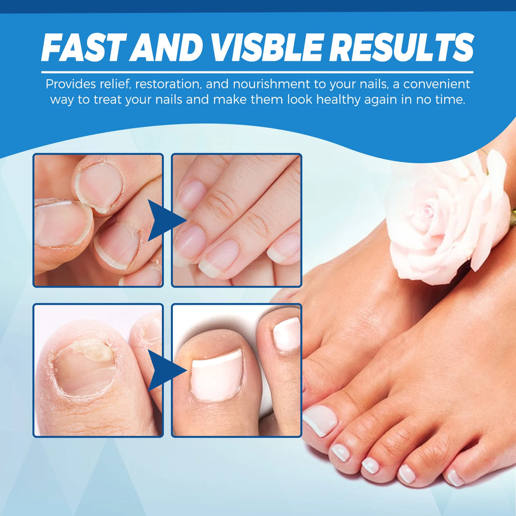 Healthy Body Laser Pen Leg Foot Care Tool for You Maintain Optimal Wellness