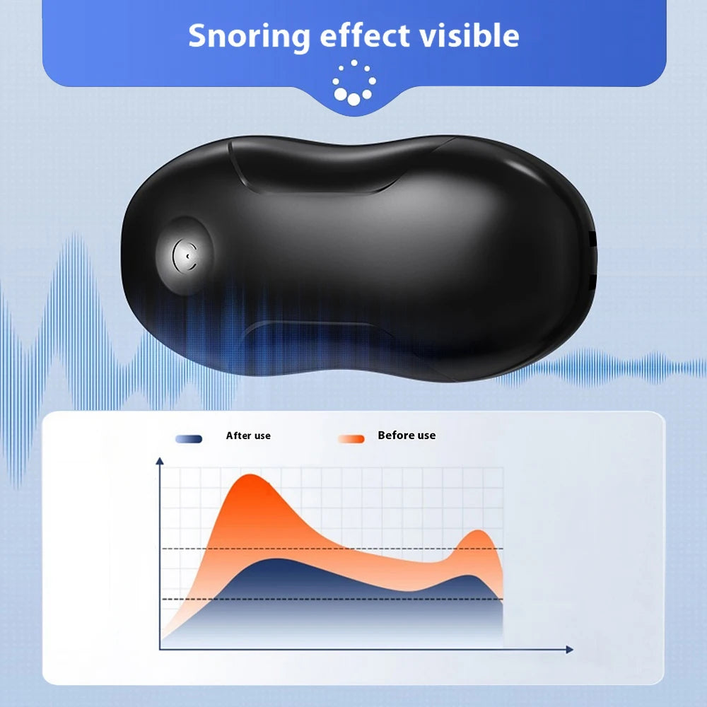 Smart Anti Snoring Device EMS Pulse Stop Snore Portable Comfortable Sleep Well Stop Snore Health Care Sleep Apnea Aid