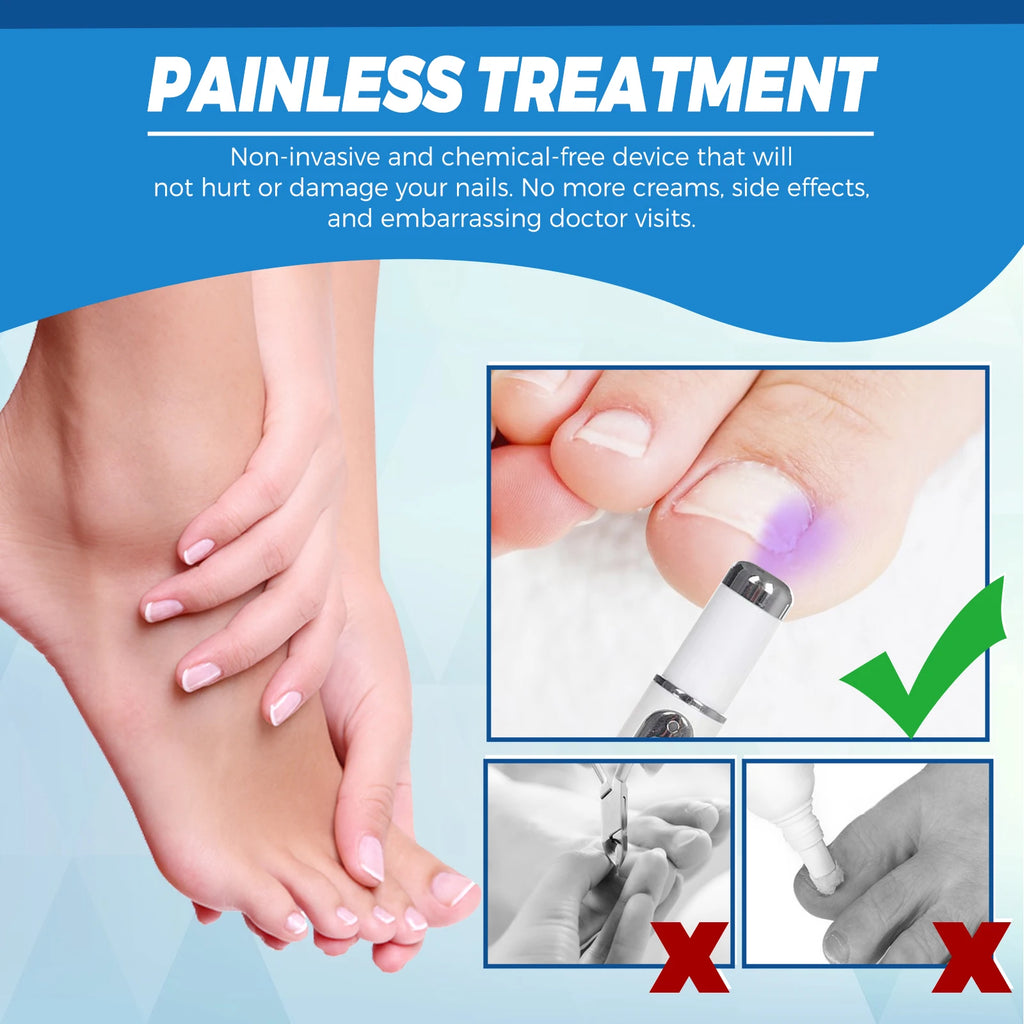 Healthy Body Laser Pen Leg Foot Care Tool for You Maintain Optimal Wellness