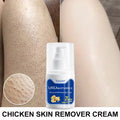 100g Chicken Skin Removal Cream Body Repair Keratosis Pilaris Rough Bumpy Pore Spots Dull Skin Care Whitening Moisturizing