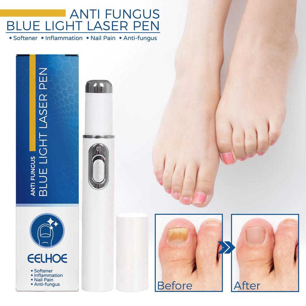 Healthy Body Laser Pen Leg Foot Care Tool for You Maintain Optimal Wellness