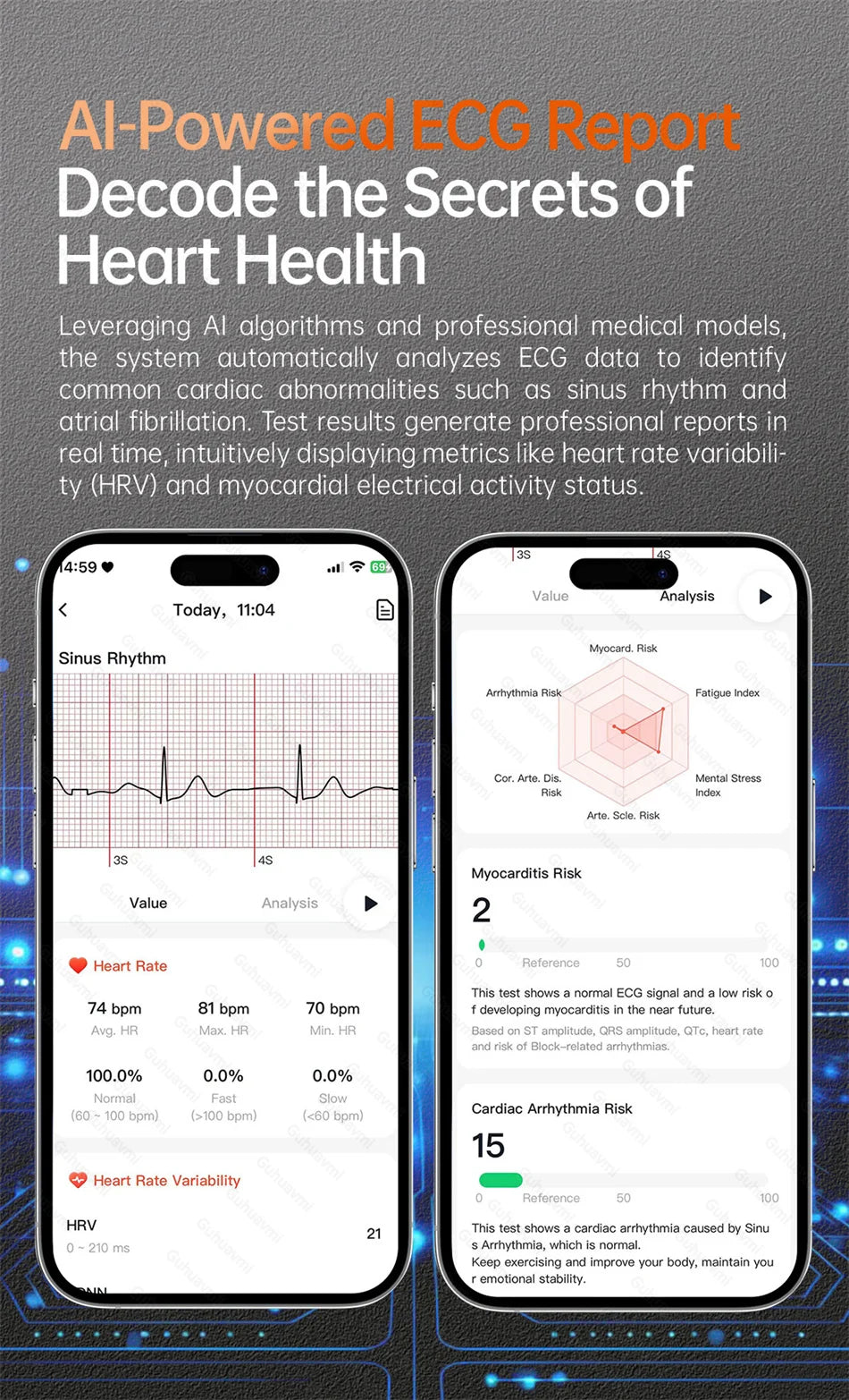 Sapphire 2025New Health managed Smart Watch Health measure Blood Fat Uric Acid Call ECG+PPG blood pressure Health Smartwatch IOS