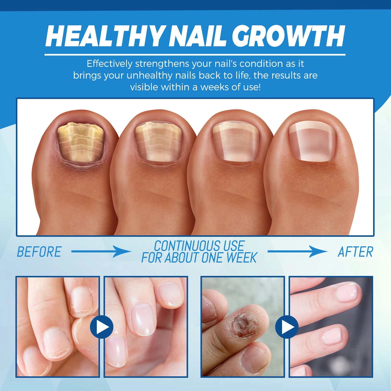 Healthy Body Laser Pen Leg Foot Care Tool for You Maintain Optimal Wellness