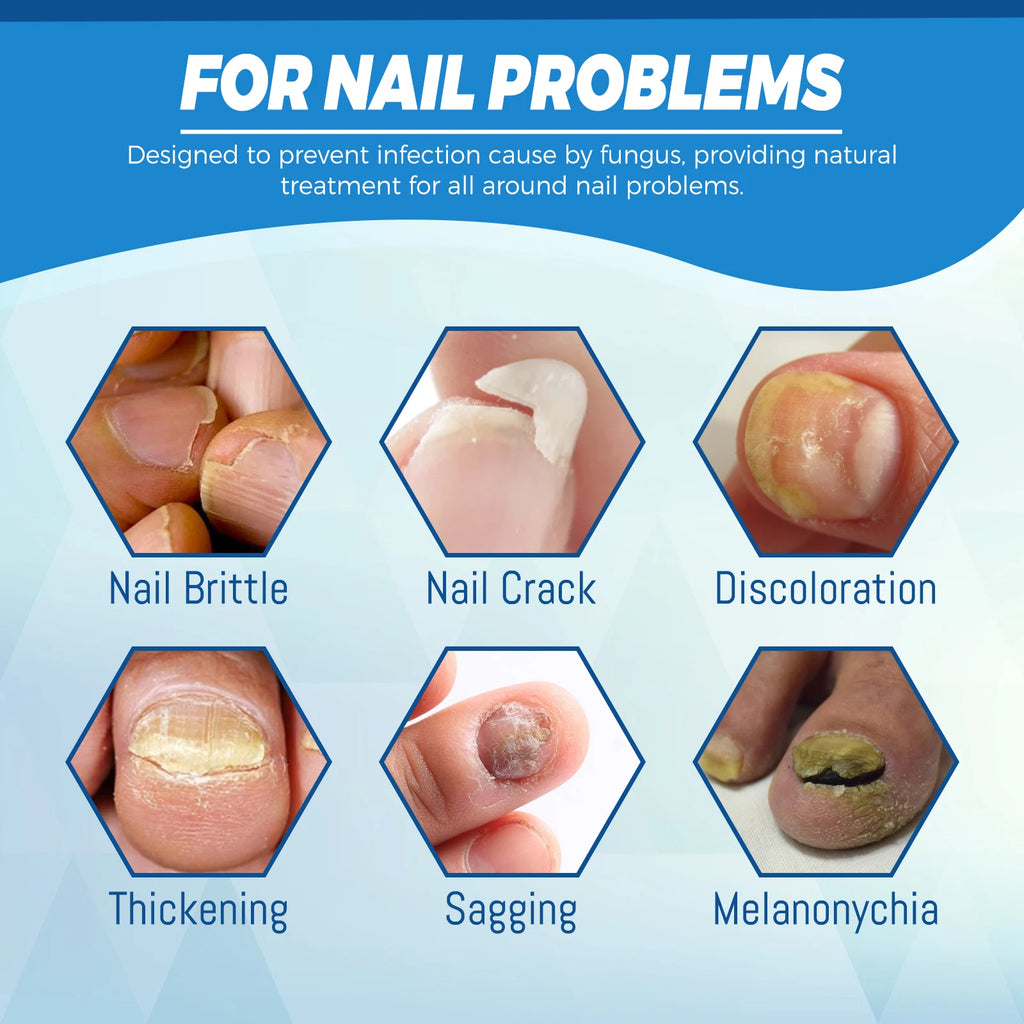 Healthy Body Laser Pen Leg Foot Care Tool for You Maintain Optimal Wellness