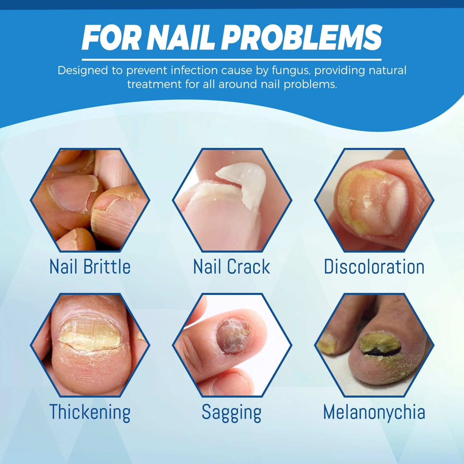 Healthy Body Laser Pen Leg Foot Care Tool for You Maintain Optimal Wellness